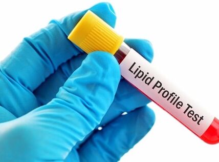 Lipid Profile Test