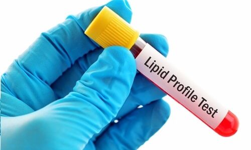 Lipid Profile Test